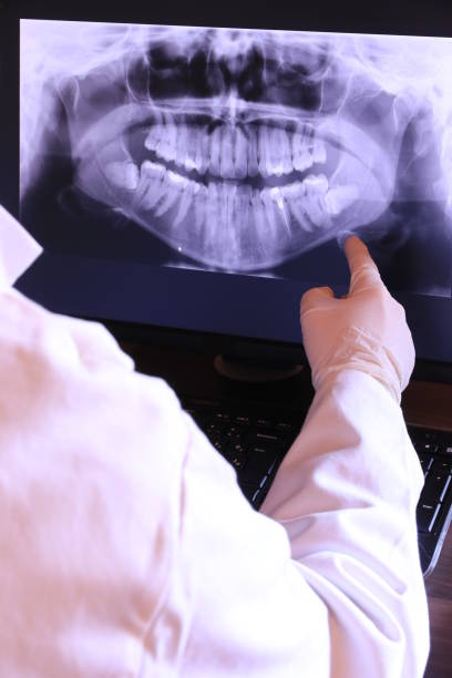 Best Emergency Dentist for Lost Fillings or Crowns in Lakeland, NY